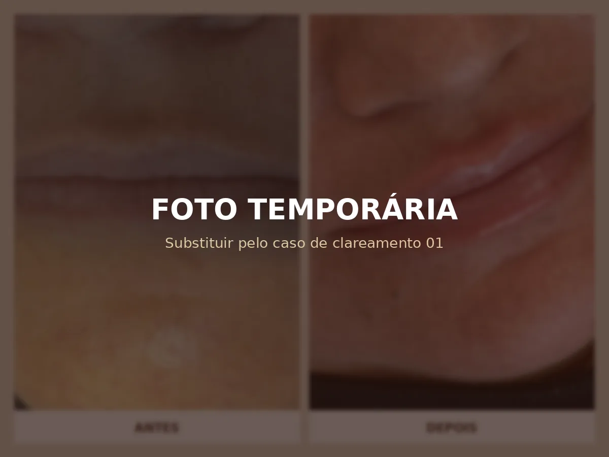 Espaço reservado para antes e depois de clareamento dental 1