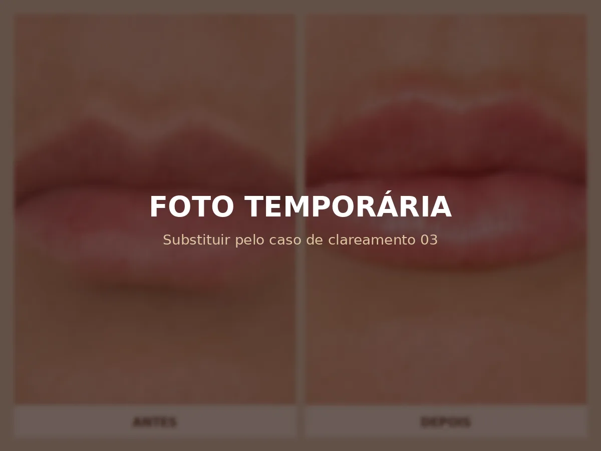 Espaço reservado para antes e depois de clareamento dental 3